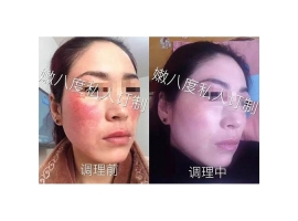 黑龍江嫩八度化妝品