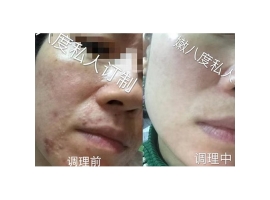 黑龍江嫩八度化妝品廠