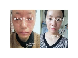 閉口痘修復